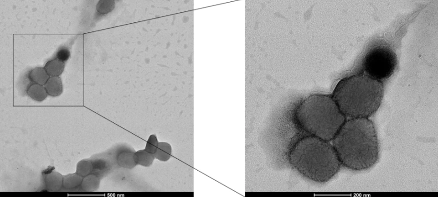 猴痘病毒電子顯微鏡成像。   圖: 翻攝自《新浪新聞》