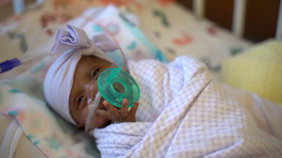 World's Smallest Surviving Baby Goes Home from San Diego Hospital