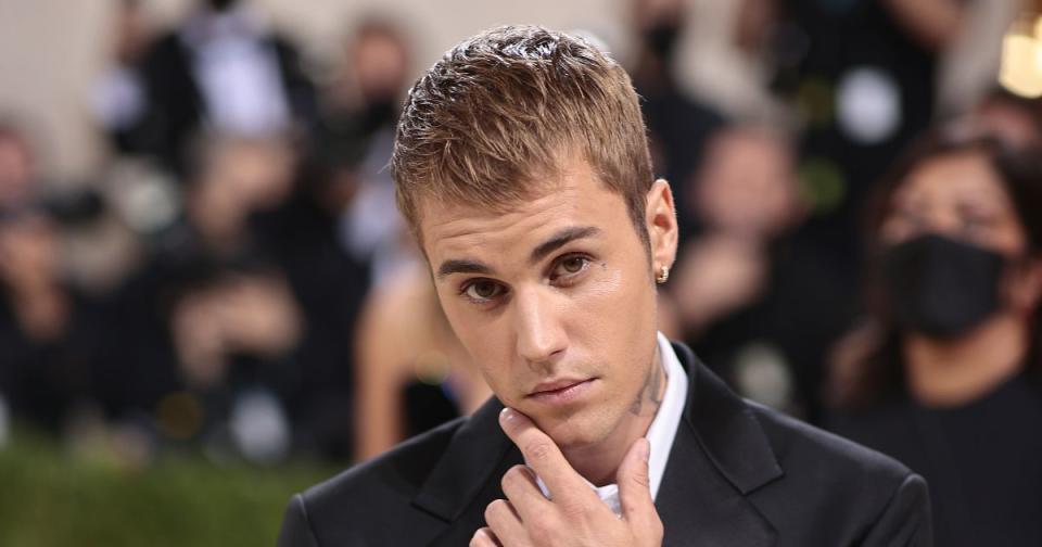 Justin Bieber, uno de los famosos que más perdieron 