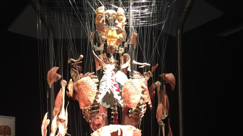 Calgary 1st city in Canada and U.S. to exhibit Body Worlds 'coupling' specimen