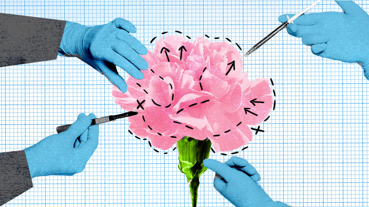 Illustration of labiplasty showing four gloved hands using medical instruments on a flower.