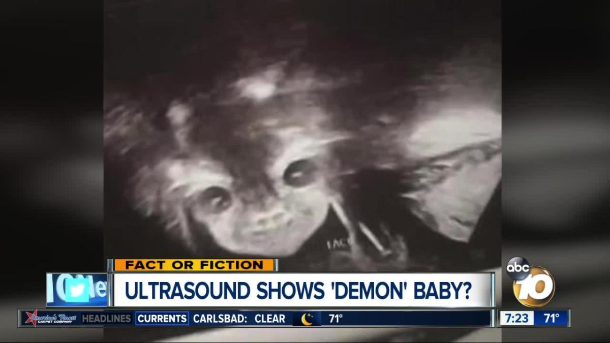 demon baby ultrasound