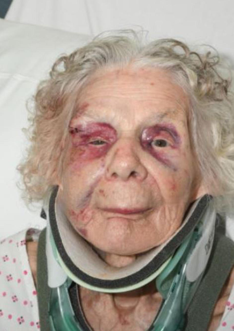 Zofija Kaczan suffered significant injuries after she was attacked in the street. Source: AAP