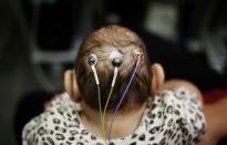 Five-month-old Laura undergoes a medical test at the University of Sao Paulo (USP) in Sao Paulo, Brazil April 28, 2016. REUTERS/Nacho Doce