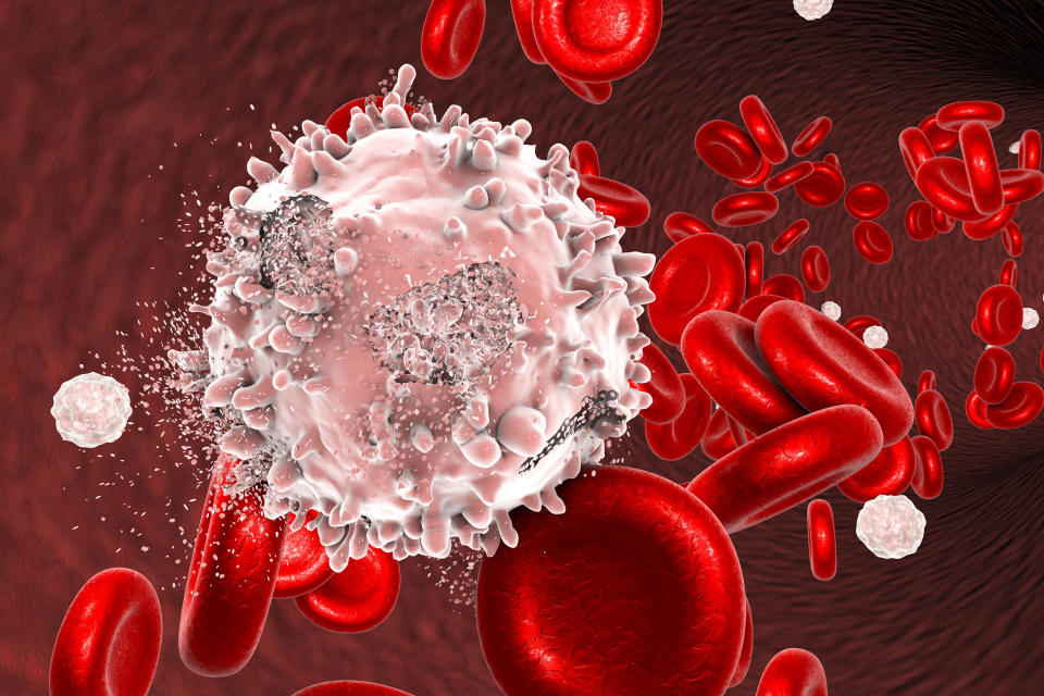 Destruction of leukaemia blood cell, computer illustration. Conceptual image for leukaemia treatment.