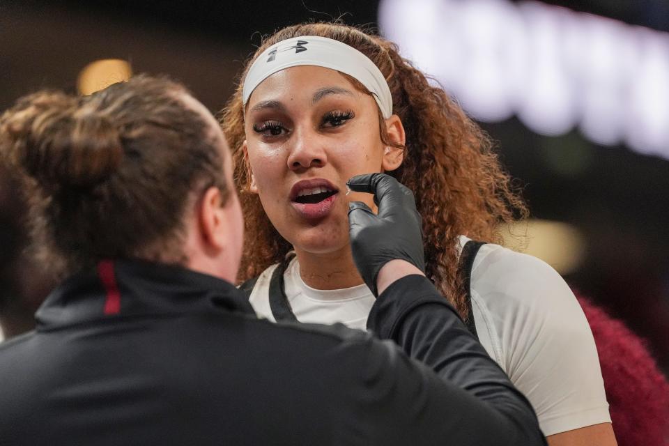 A trainer treats the lip of South Carolina center Kamilla Cardoso during the second half of the SEC title game.