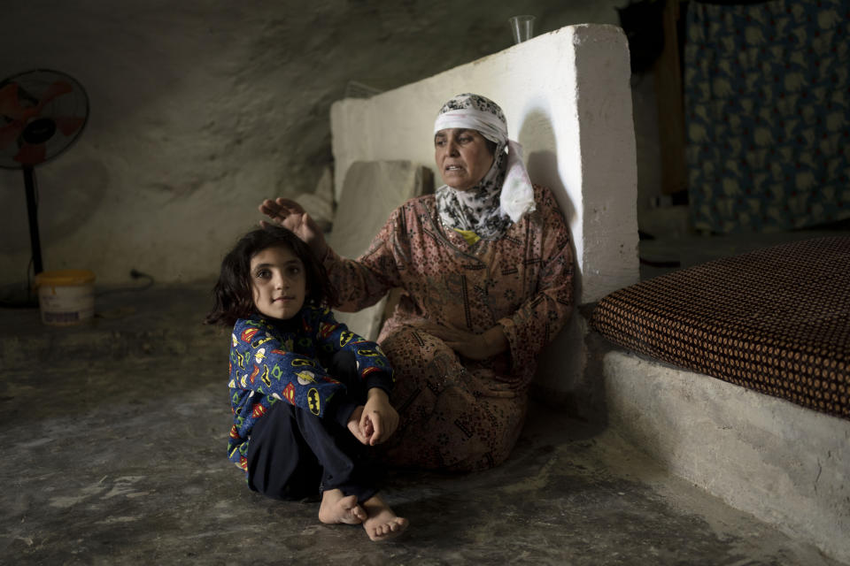 Kawrtha Ali, 6, who was stung by a scorpion and rode a donkey for miles to an ambulance after the Israeli military seized her family's car in Masafer Yatta, south Hebron hills, sits with her mother Monday, Sept. 4, 2023. This month, the Israeli military confiscated cars from their community, fircing sick and injured residents to ride donkeys to the hospital — a bumpy two-hour trip that takes 30 minutes by car. Israel contends that Palestinians living there were never permanent residents and it has the right to declare the area a closed military zone. (AP Photo/Maya Alleruzzo)