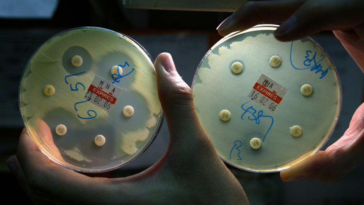  Yellowish bacteria called Pseudomonas aeruginosa shown growing in two circular lab dishes; the lab dish on the left contains antibiotics that the bacteria can't grow near, while the bacteria in the right dish are still successfully growing next to the antibiotics. 