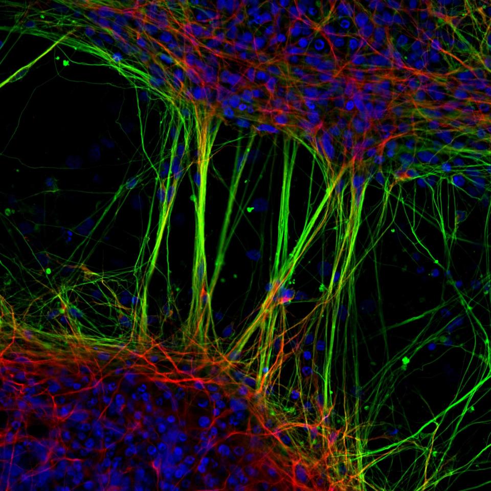 Human neurons derived from neural stem cells