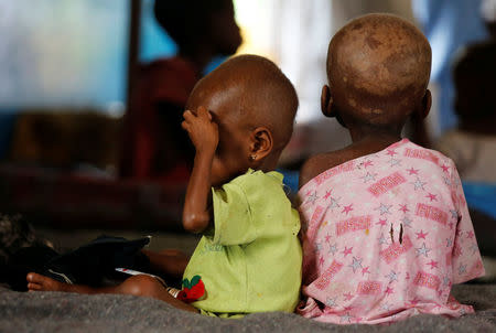 Ntumbabu Kalubi, 4, and his sister Ntumba Kalubi, 2, internally displaced and severely acute malnourished children wait to receive medical attention at the Tshiamala general referral hospital of Mwene Ditu in Kasai Oriental Province in the Democratic Republic of Congo, March 15, 2018. Picture taken March 15, 2018. REUTERS/Thomas Mukoya