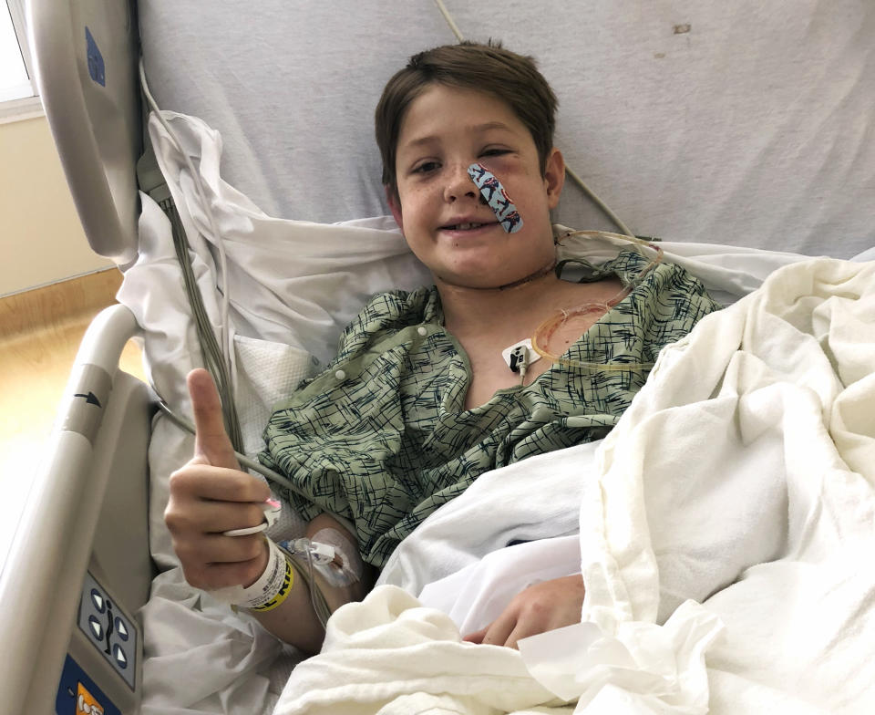 Esta foto del lunes 10 de septiembre del 2018 proporcionada por Shannon Miller muestra al hijo de Miller, Xavier Cunningham, de Harrisonville, Missouri, dando un saludo con el dedo pulgar mientras se recupera en el Hospital de la Universidad de Kansas, en Kansas City, Kansas, luego que le removieran una brocheta que le atravesó la cabeza, de la cara hasta arriba del cuello. (Shannon Miller via AP)