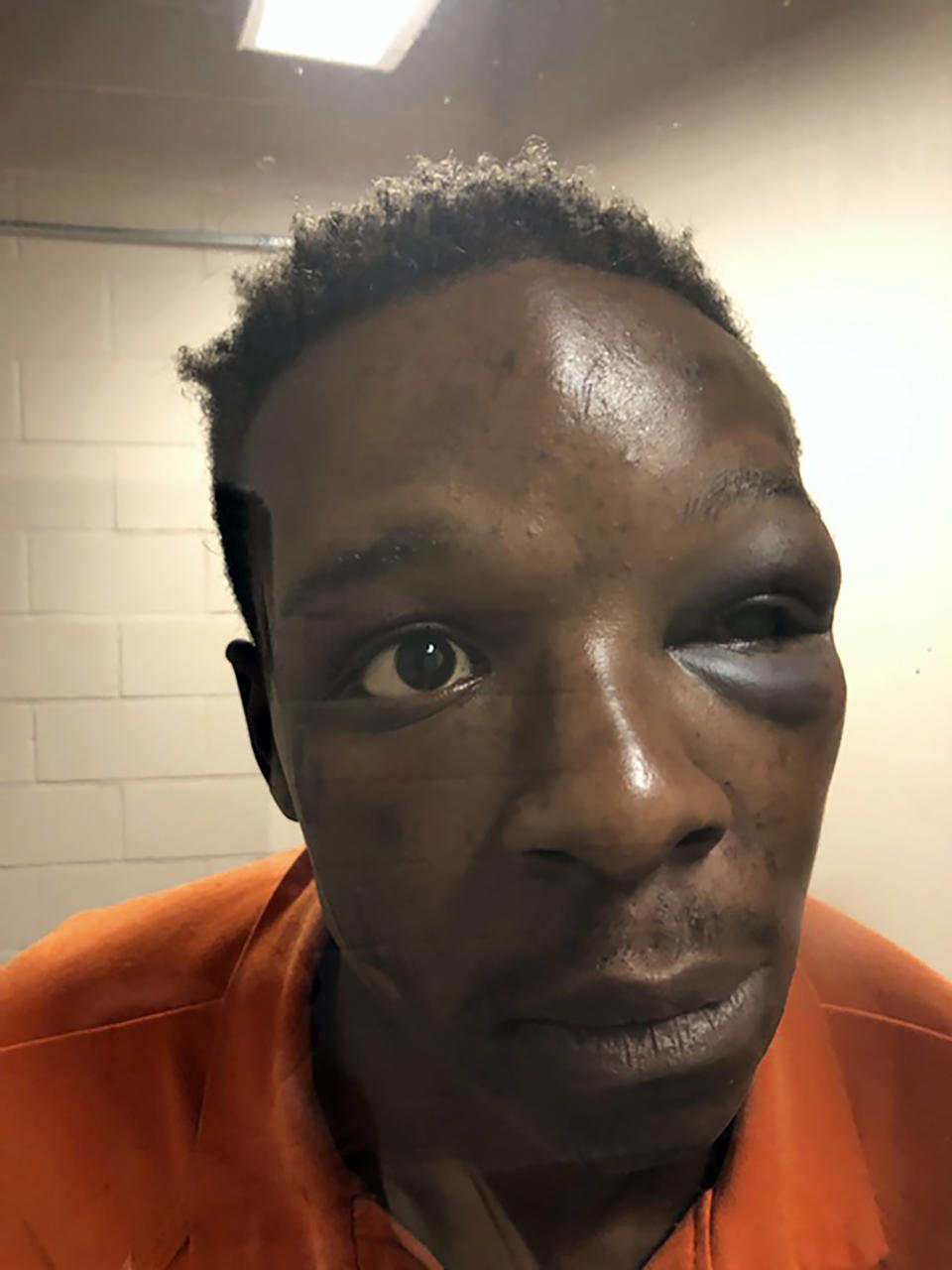 Roderick Walker at the Clayton County Jail in Jonesboro, Georgia, having been punched repeatedly by a sheriff's deputy during a traffic stopAP