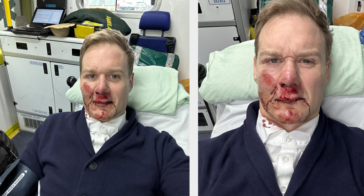 Dan Walker said he was 'glad to be alive; after being hit by a car on his bike. (Twitter/Dan Walker)