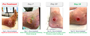 Patient Case Study Example B