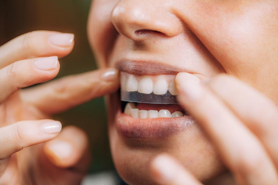 These Are the Best Teeth Whitening Kits to Keep Your Smile Nice and Bright, According to Experts