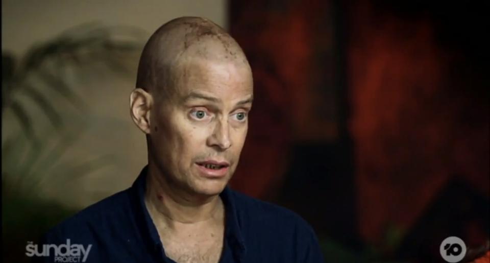 Tom is going ahead with a groundbreaking new treatment Photo: Channel 10