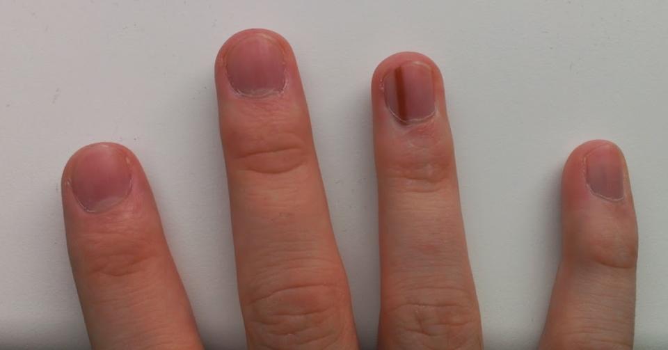 A tiny strip on someone's nail