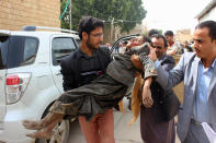 <p>A Yemeni child is transported to a hospital after being wounded in a reported air strike on the Iran-backed Huthi rebels’ stronghold province of Saada, Aug. 9, 2018. (Photo: Stringer/AFP/Getty Images) </p>