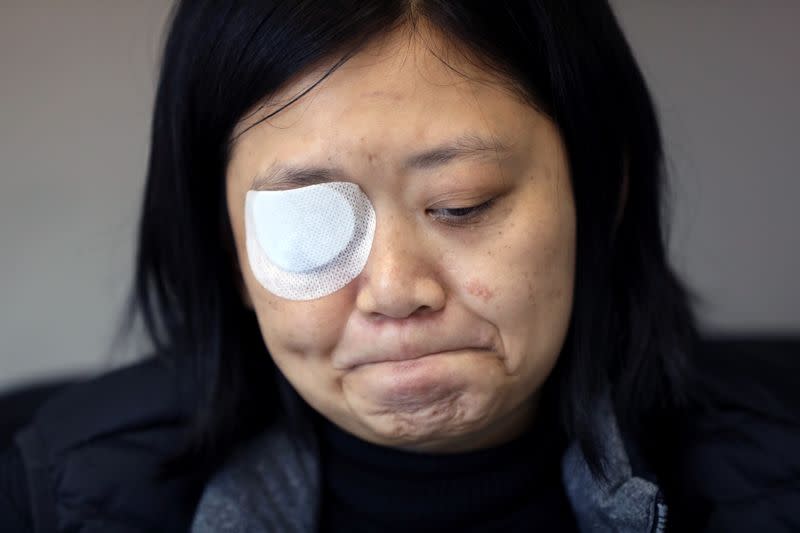 Indonesian journalist Veby Mega Indah, whose right eye was severely injured by Hong Kong police during a protest, becomes emotional recalling the incident during an interview with Reuters in Hong Kong, China