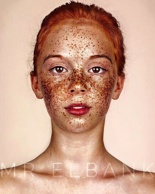 Elbank looks for freckled models who are ‘incredible-looking humans’