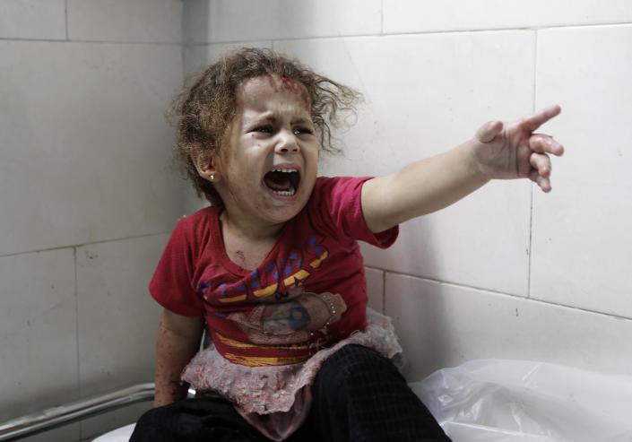 A screaming Palestinian child is treated at al-Shifa hospital after Israeli forces shelled her home in Gaza City on July 18, 2014 (AFP Photo/Mohammed Abed)