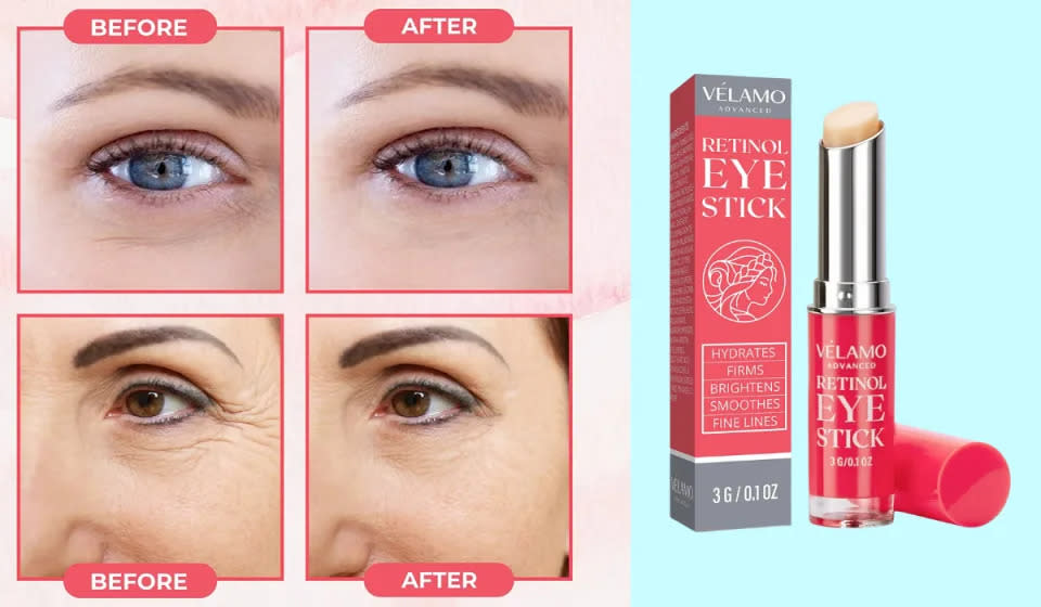 Muchos usuarios han notado una mejora notable tras usar el stick con retinol para el contorno de ojos. (Foto: Amazon)