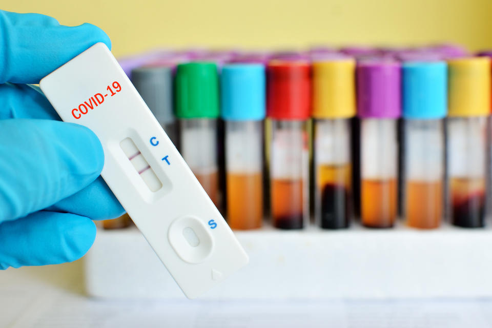 Cassette rapid test for COVID-19 or novel coronavirus 2019 found in Wuhan, China