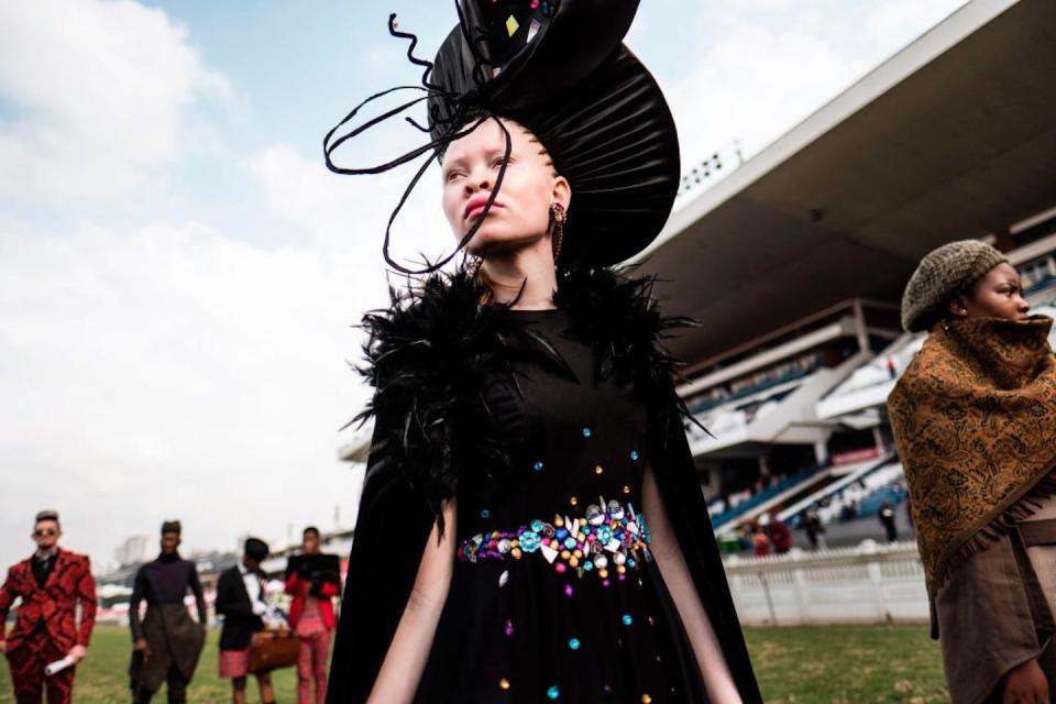 An albino model during a 2017 fashion show in Durban, South Africa. <a href="https://www.gettyimages.com/detail/news-photo/an-albino-model-presents-a-creation-by-a-local-designer-news-photo/805234174?phrase=albino%20african&adppopup=true" rel="nofollow noopener" target="_blank" data-ylk="slk:Marco Longari/AFP via Getty Images;elm:context_link;itc:0;sec:content-canvas" class="link ">Marco Longari/AFP via Getty Images</a>