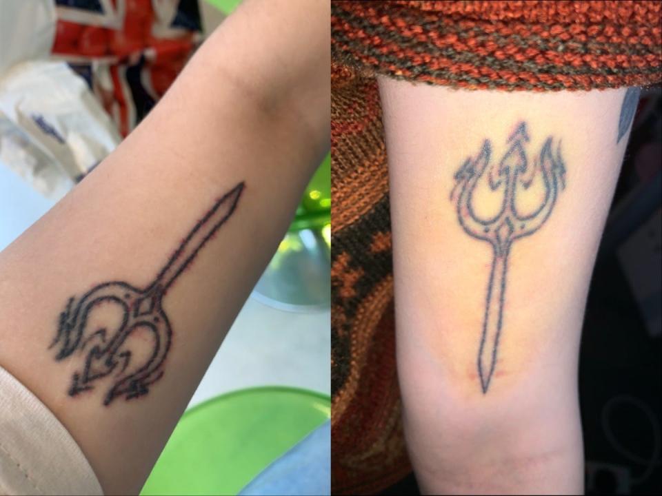 Right: bruising of a lasered tattoo. Left: pinprick bleeding.