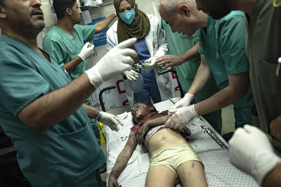 CORRECTS DAY TO MONDAY A young Palestinian girl is treated in a hospital after she was injured in an Israeli bombardment of the Gaza Strip in Khan Younis, Monday, Nov. 6, 2023. (AP Photo/Fatima Shbair)