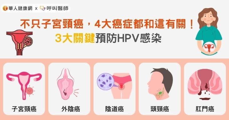 不只子宮頸癌，4大癌症都和這有關！3大關鍵預防HPV感染