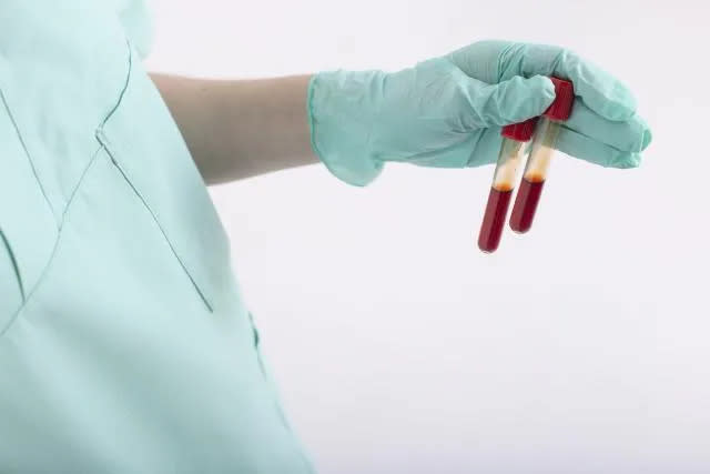 <strong>抽血檢查中，有一項數值叫「C-Peptide」可做為胰臟殘存機能初步的檢測。（示意圖／資料庫）</strong>