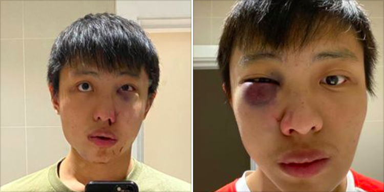 Jonathan Mok, 23, was assaulted in February along Oxford Street in London. (Facebook/Jonathan Mok)