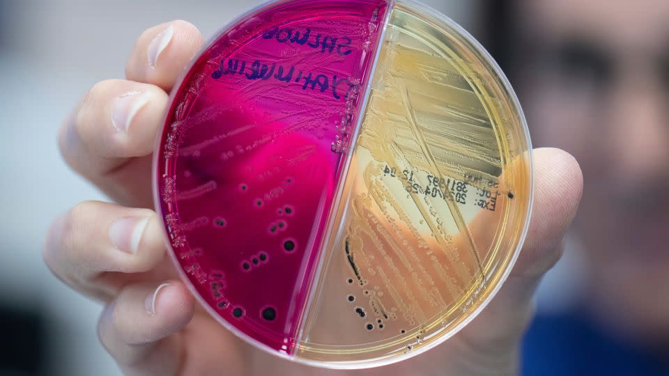 The gut is teeming with microbes &#x002014; bacteria, viruses and fungi &#x002014; that influence human health. - Boris Roessler/picture-alliance/dpa/AP