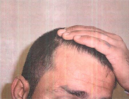 A detainee shows his scalp in an undated photo from Iraq's Abu Ghraib prison, among 198 images released in a Freedom of Information Act (FOIA) lawsuit against the U.S. Department of Defense in Washington, DC February 5, 2016. REUTERS/DoD/Handout via Reuters