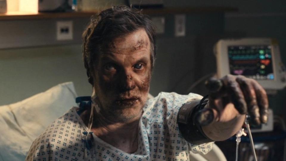 A man with severe frost burn in a hospital bed points on True Detective: Night Country