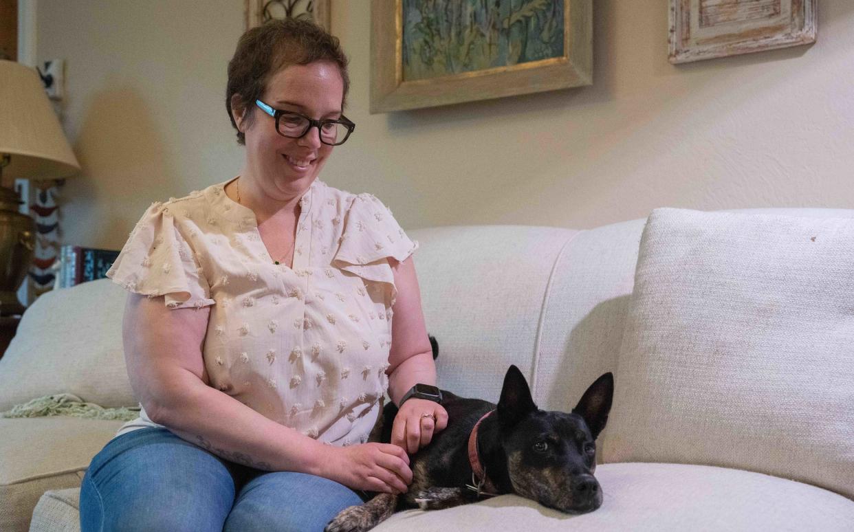 Emily Rombach sits on her couch with her dog Riley. Riley was bit by a poisonous spider during her chemo and had to be separated as they both went through their treatments.
