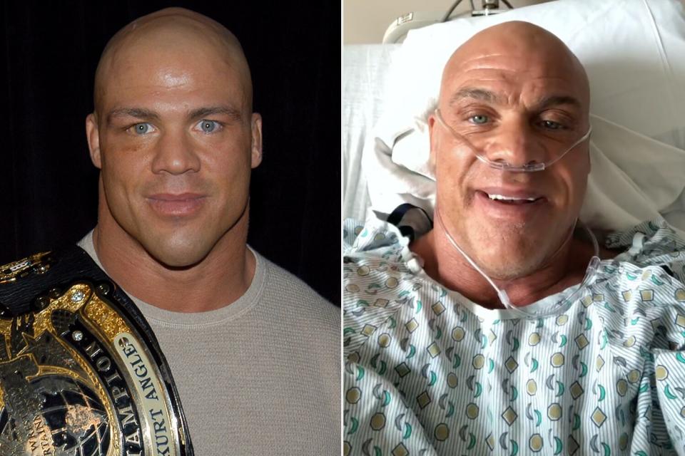 Former WWE Superstar Kurt Angle Recovering After Having Both Knees Replaced;