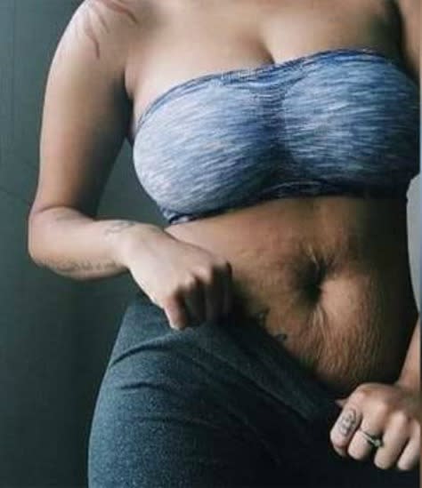 A Kiwi mother has shared a picture of her post-pregnancy stomach but the reactions weren’t all positive. Source: Facebook