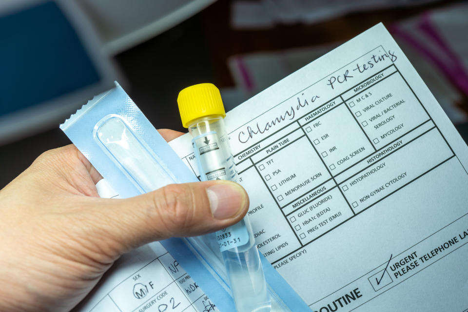 A hand is holding a Chlamydia PCR testing kit with a swab and test tube. The test form includes fields for routine and urgent testing and various sample types