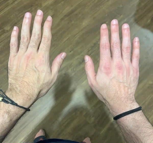 A person's hands that look completely different