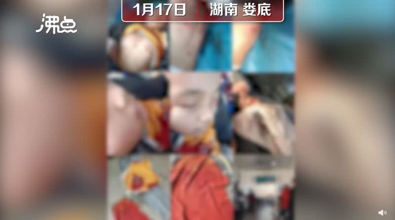 男童的媽媽一開始還以為是發生車禍，送到醫院才知兒子是被惡意刺傷。（圖／翻攝自沸點視頻）