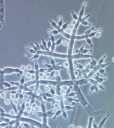 Estructuras productoras de esporas del hongo <em>Trichoderma harzianum</em>. <a href="https://commons.wikimedia.org/wiki/File:Trichoderma_harzianum.jpg" rel="nofollow noopener" target="_blank" data-ylk="slk:Departamento de Agricultura de los Estados Unidos / Wikimedia Commons;elm:context_link;itc:0;sec:content-canvas" class="link ">Departamento de Agricultura de los Estados Unidos / Wikimedia Commons</a>