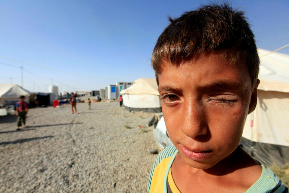 A displaced boy at Deepaka camp