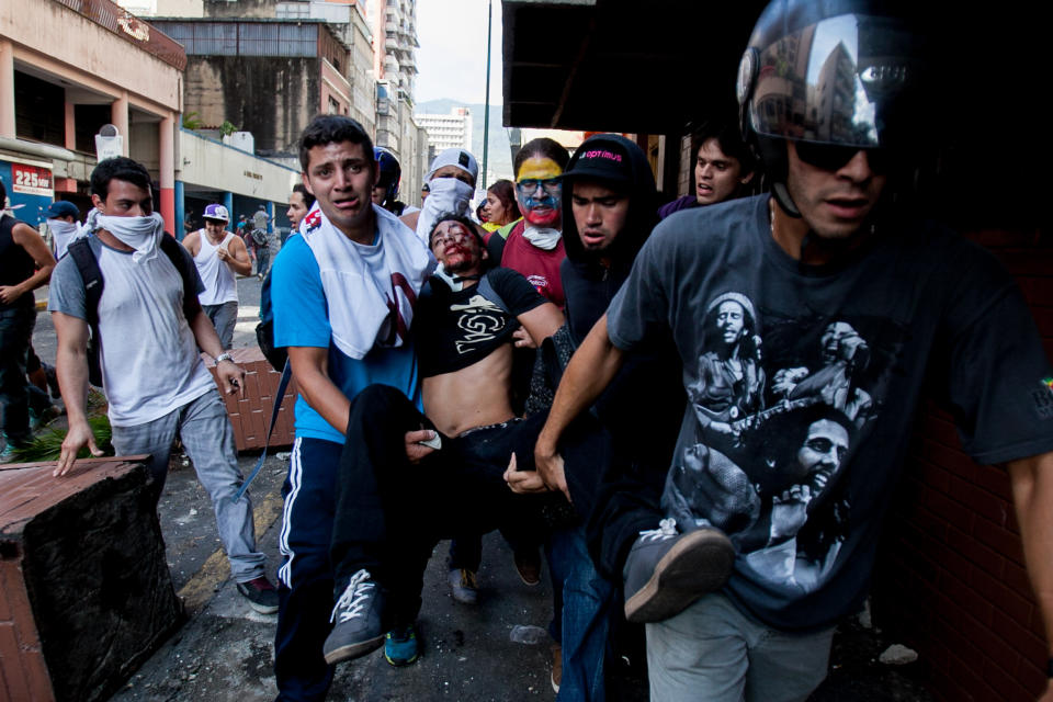 Un estudiante que resultó herido en la cabeza es llevado a un lugar distante de donde ocurrieron disturbios durante una manifestación de opositores en Caracas, Venezuela, el miércoles 12 de febrero de 2014. Dos hombres fallecieron y cuatro resultaron heridos a consecuencia de disparos de arma de fuego durante unos violentos incidentes. (AP Photo/Alejandro Cegarra)