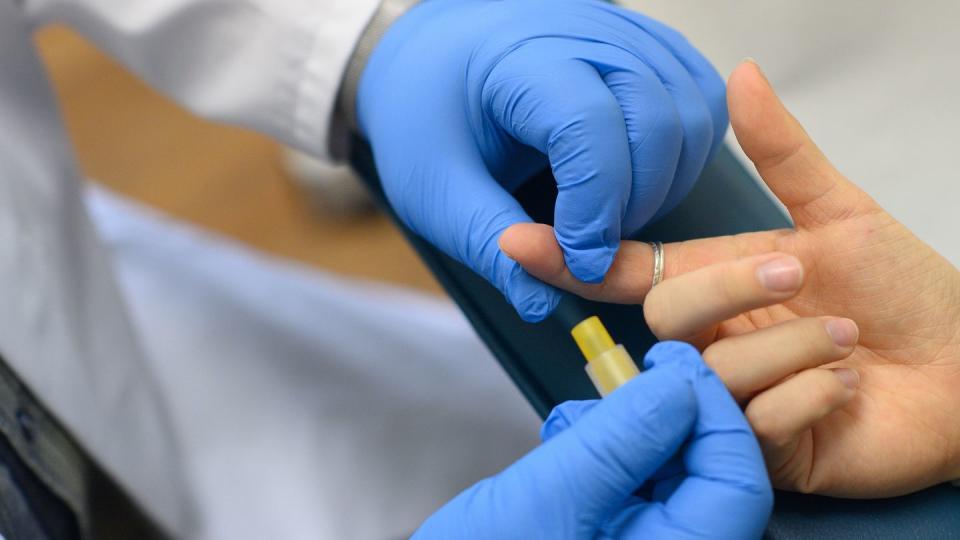 Die Studie mit dem HIV-Impfstoff brachte nicht die erhofften Ergebnisse. (Bild: dpa)