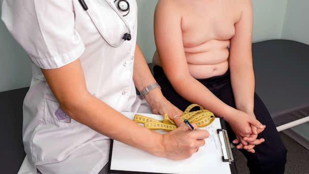 PHOTO: FILE - Doctor examining an overweight boy (Elena Bessonova/Getty Images/iStockphoto, FILE)