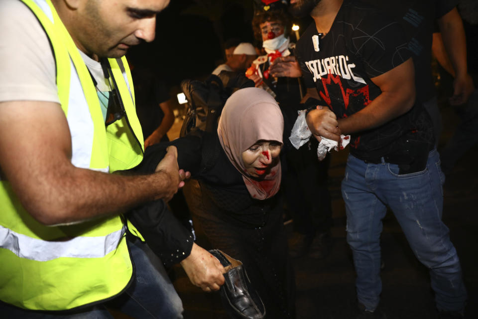 An injured Palestinian demonstrator is helped during clashes at Damascus Gate just outside Jerusalem's Old City, Saturday, May 8, 2021. (AP Photo/Oded Balilty)