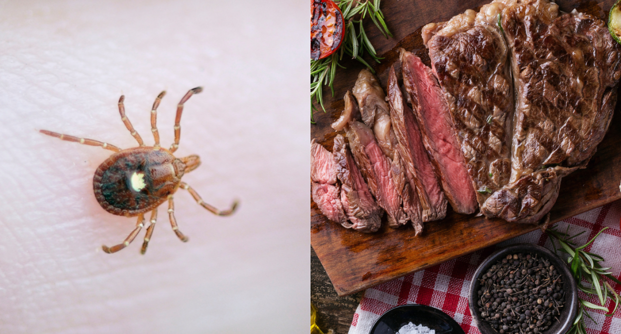 A Windsor, Ont. women developed a life-threatening allergy to red meat after she was bitten by a lone star tick. (Images via Getty Images)