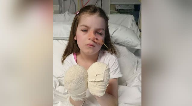 In 2015, nurses were forced to wrap Chloe's hands so she would stop removing her nasogastric intubation tube. Photo: Facebook/ Save Chloe Saxby